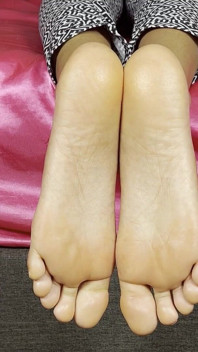 Godaan tapak kaki tepi katil
