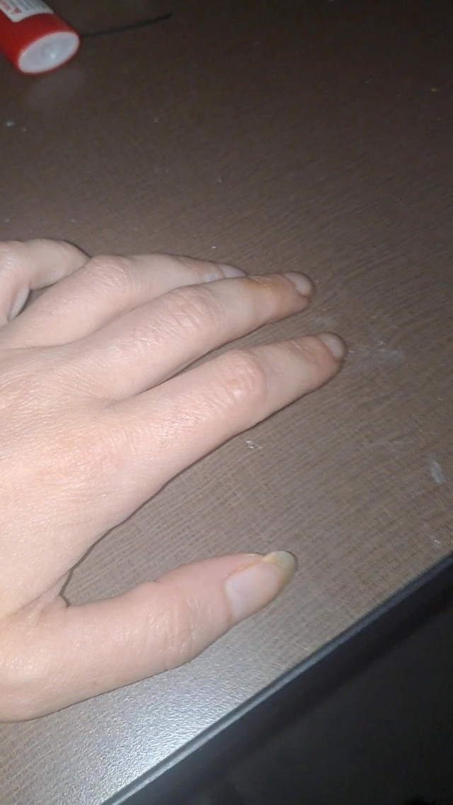 Long Claw Tapping (Naughty alchemy)