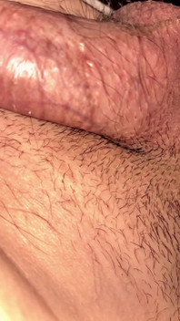 Help I Can’t Cum