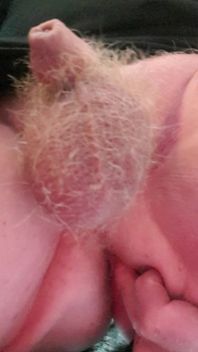 M Tinydick