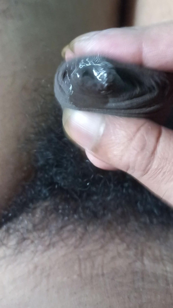 Lustyizlife: Těsná předkožka phimosis čůrák zblízka kape pre sperma, dokud se neudělá