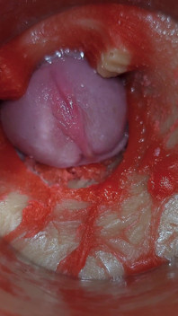 กล้องลึกในหี จับภาพน้ำสเปิร์มพุ่งทะลักมหาศาลมาก ASMR