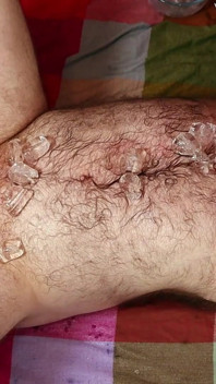 Крижаний холод, але все ще до біса гарячий - ftm ice play