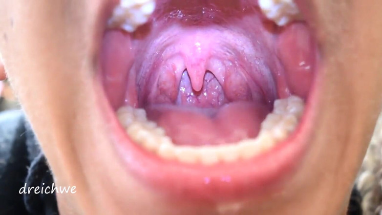 Dreichwe: Uvula fetysz usta