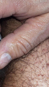 Anal Masturbation