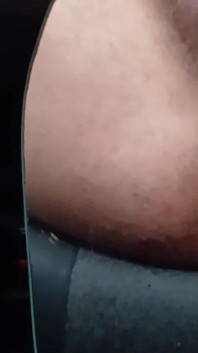 Anus XXX