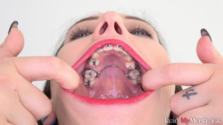 Inside My Mouth: Video de fetiche de boca con Bara mostrando frenillos dentales.