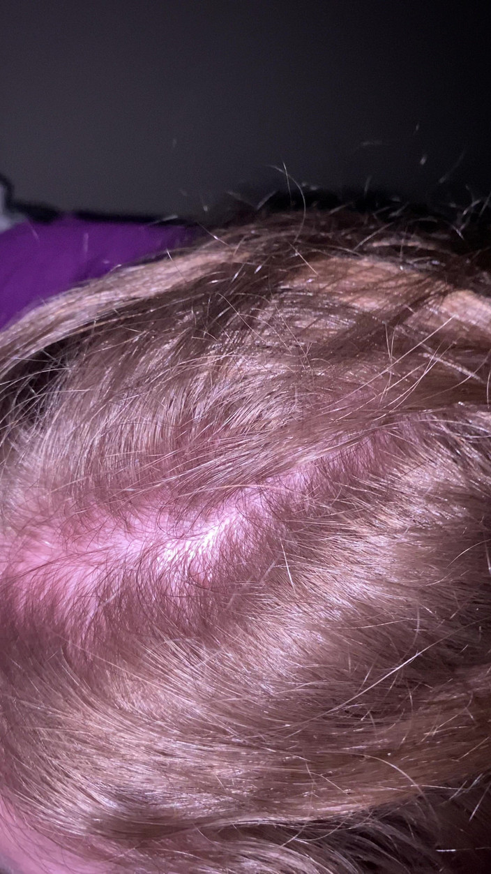 Kat G: Ona o Büyük Merkser Sakso'sını veriyor