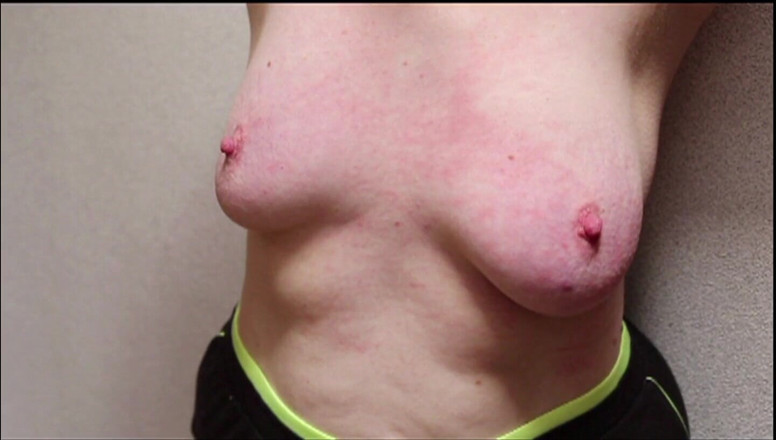 Bouncy Tits Action: Tit whipping in slow motion full