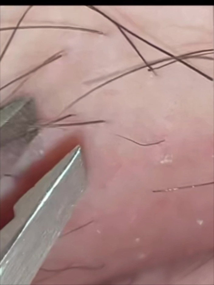 SatisfyingDillyDally: Indizi alla levigatezza Dettagliata