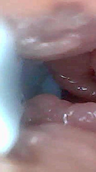 Guida Visiva Alla Stimolazione Del Punto G E All'orgasmo - Prospettiva Endoscopica