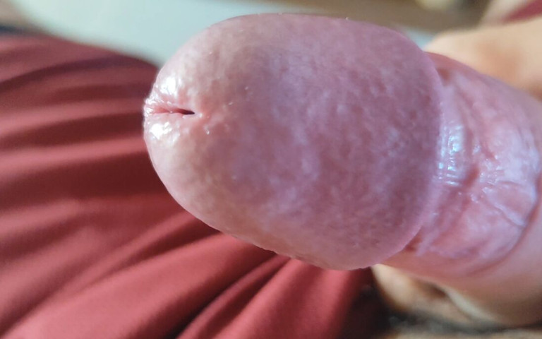 The Blossoming of Extensive Elastic Phimosis. (Straight Daddy Club)