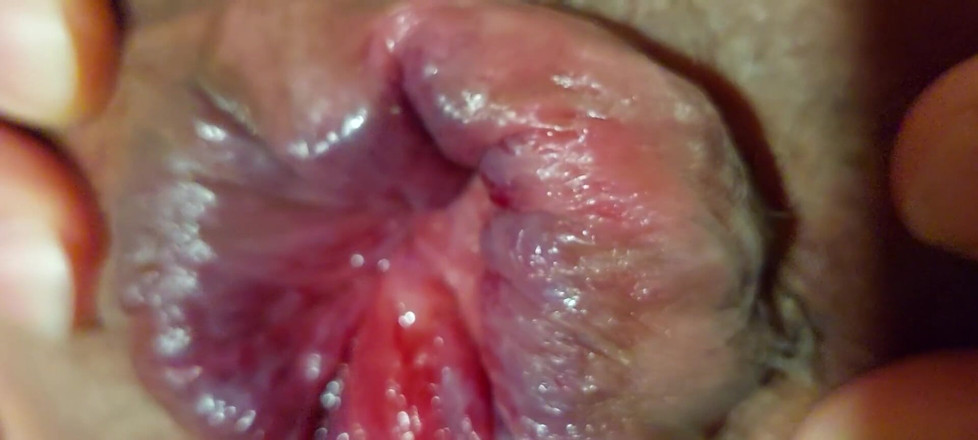 Dildo Man and Cross Hard Sex: Cận cảnh lỗ hậu mở