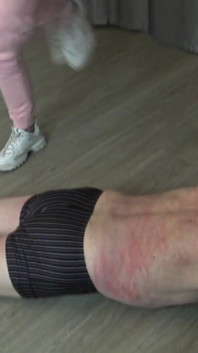Old Patient Kicked by Home Help