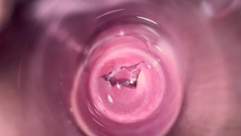 Mia Foster: Inside Mia's Vagina, Internal Camera in Teen Pussy