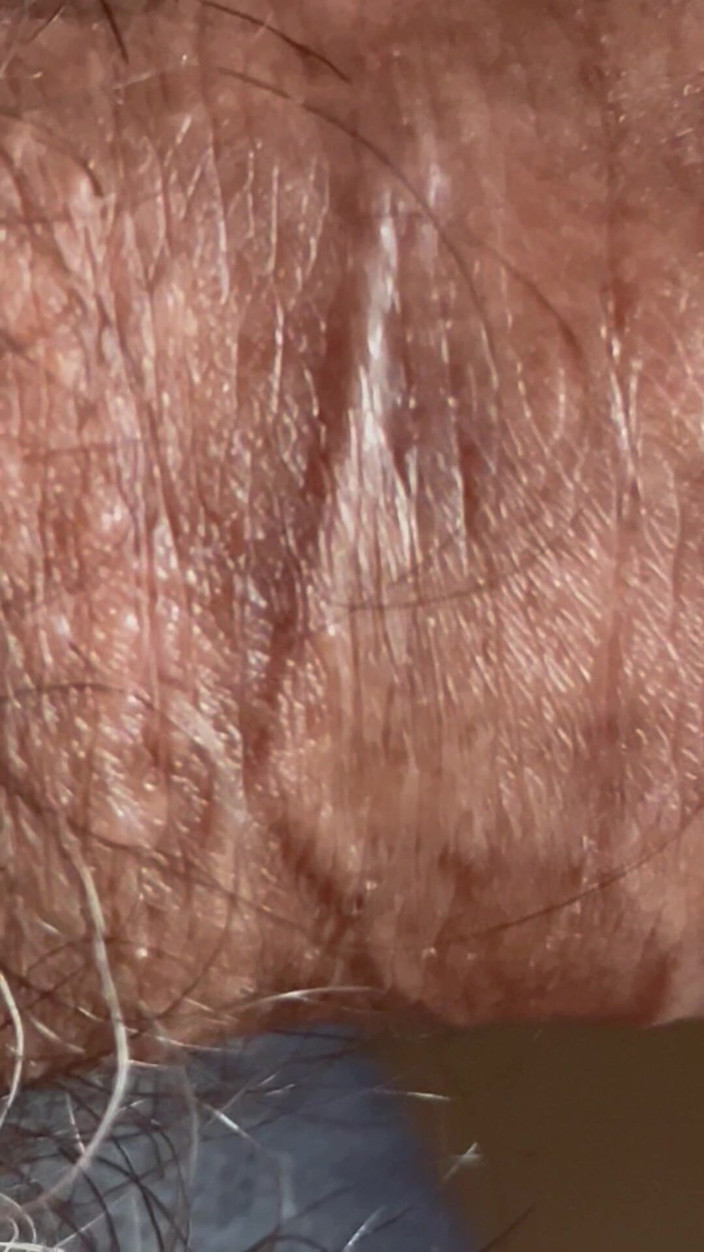 ragil01: Primer Plano Del Pene Con Una Vena