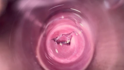 Mia Foster: Inside Mia's Vagina, Internal Camera in Teen Pussy