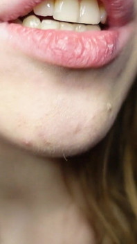 Je Te Parle Des Obturations Dans Mes Dents Et Des Visites Chez Les Dentistes
