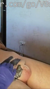 #205(2) Male Waxing. Smooth Penis and Scrotum