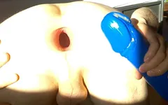 My Biggest Gape 2015 Giant Asshole