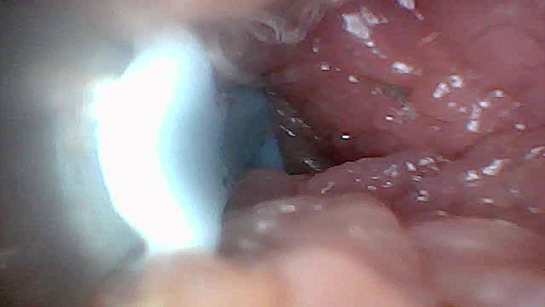 Ladybottox: Guia Visual para Estimulação e Endoscopia de Ponto G