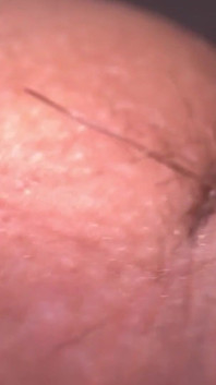 Macro Skin pada batang saya