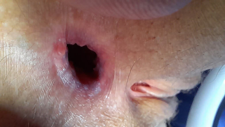 Lala Licious: Великий Агапе, окончательный результат