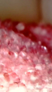 Medical Endoscope Oral Exam: Gummy Chewing, Extreme Teeth & Tongue Macro