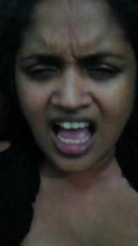 Kesan Pancutan muka Bhabhi Desi