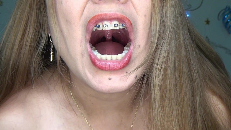 Angel eyes studio: Am Înghițit Niște Viermi Gumați Foarte Lungi!!