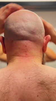 Shave Bald Head and Worship