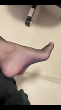 Nylon Feet