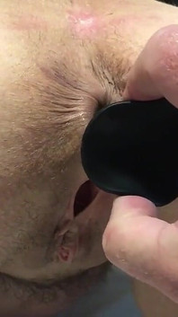 Removing Big Butt Plug From 60 Year Old Wife MILF GILF Granny Mature Anal