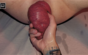 Arty Boer: アーティ・ブーアとプロラプシボーイ。