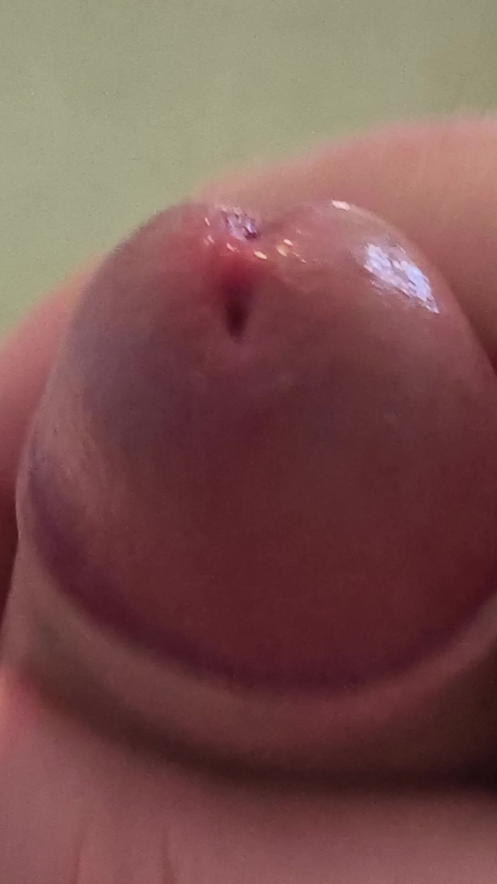 Ugly dick: Cocoșul Păros Jucat