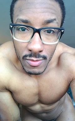 I Hurt My Butt. Amadeus Mode