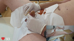 Clinical Climax: Catheter प्रविष्टि