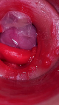La caméra dans une chatte profonde filme une éjaculation énorme avec un préservatif coincé !