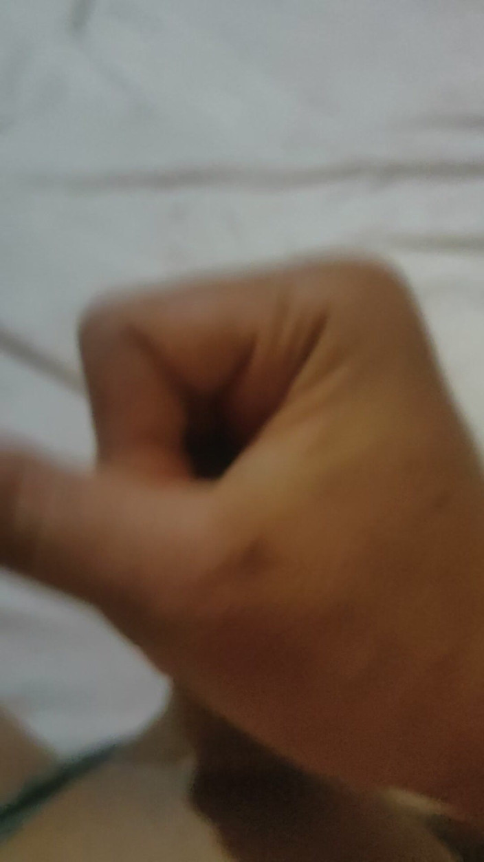 ArchAss: Đói cho Collab!