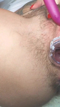 야외에서 speculum_orgasm 클로즈업