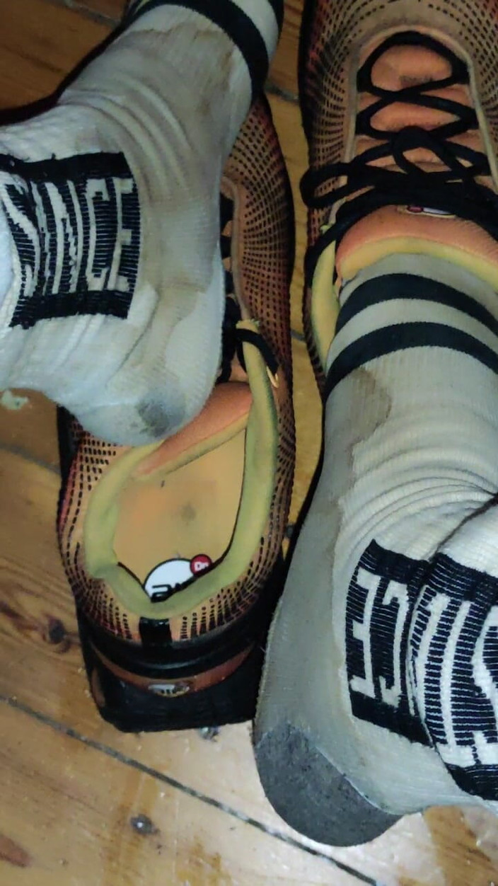 SmokedAlloy2: Dirtyjunkbro nepotřebují záchod, aby se vyčůrali. Dělá to všude! Mega špína!