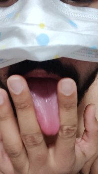 Dickontop