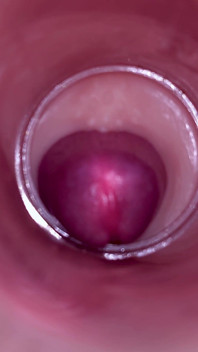 Ženské inseminace - vnitřní kamera zachycuje hlubokou mužskou ejakulaci