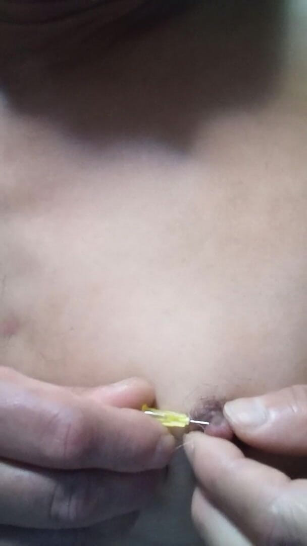 Osiritikubi: Niple needle