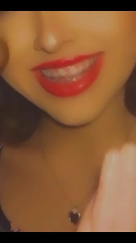 Braceface Baby