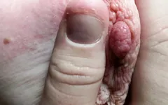 Dê um tapa nos meus peitos e puxe meus mamilos