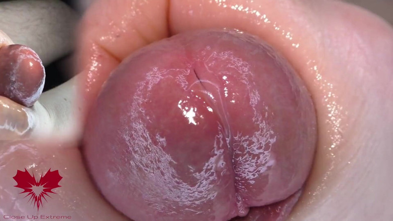 Close Up Extreme: Super Nahaufnahme der Eichel. Harnröhrenspiele mit dem Dilator.