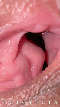 When You Work as a Gynecologist and Your Client Cums From Excitement!