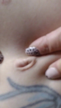 Navel retas Yanking poking luktar närbild