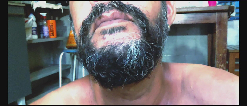 Rock F hairy: nee subah